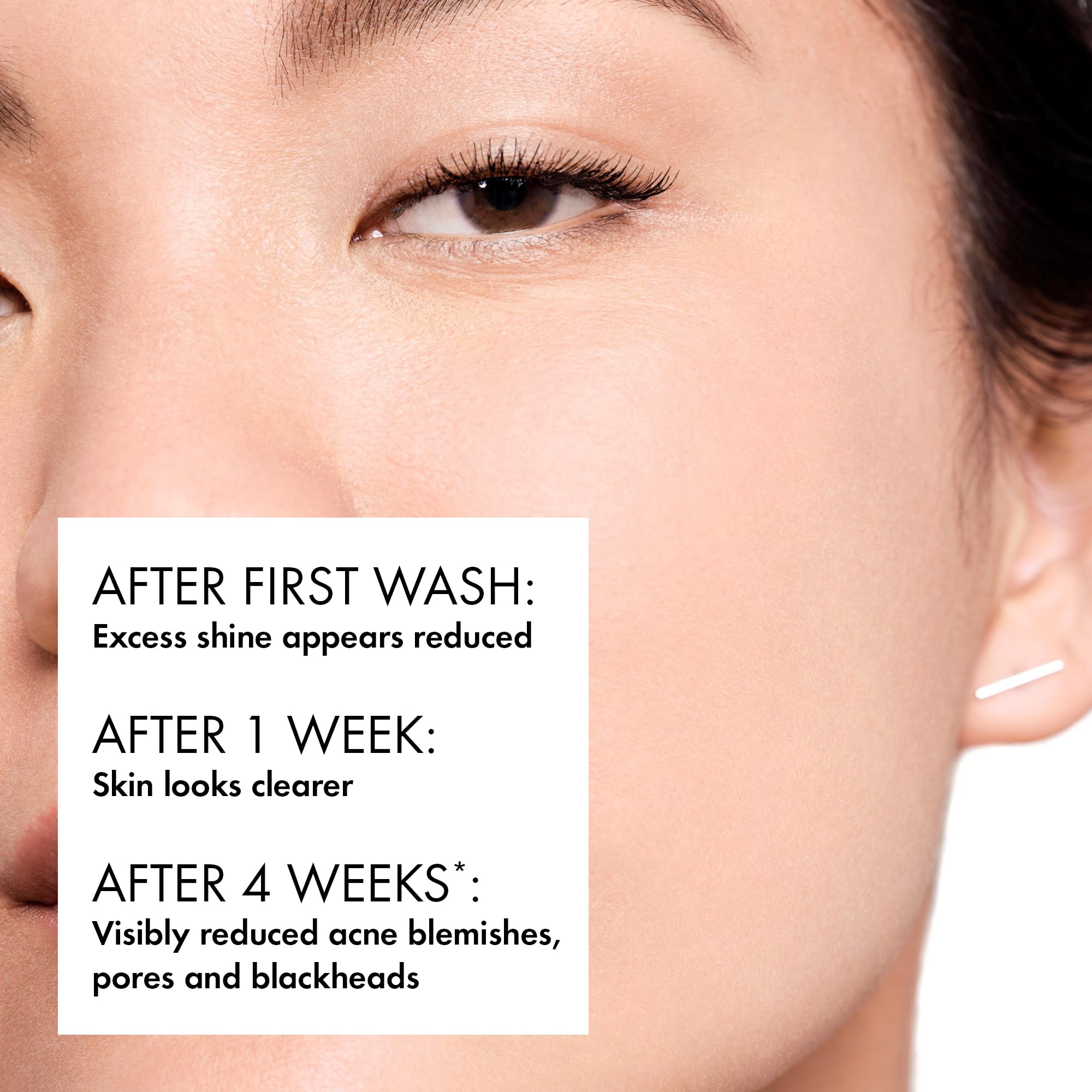 Vichy Normaderm Phytosolution Intensive Purifying Gel for Oily Skin - 200ml, Salicylic Acid Face Wash